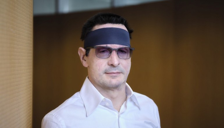 Innogy offers reward in CFO acid attack case Innogy offers reward in CFO acid attack case
